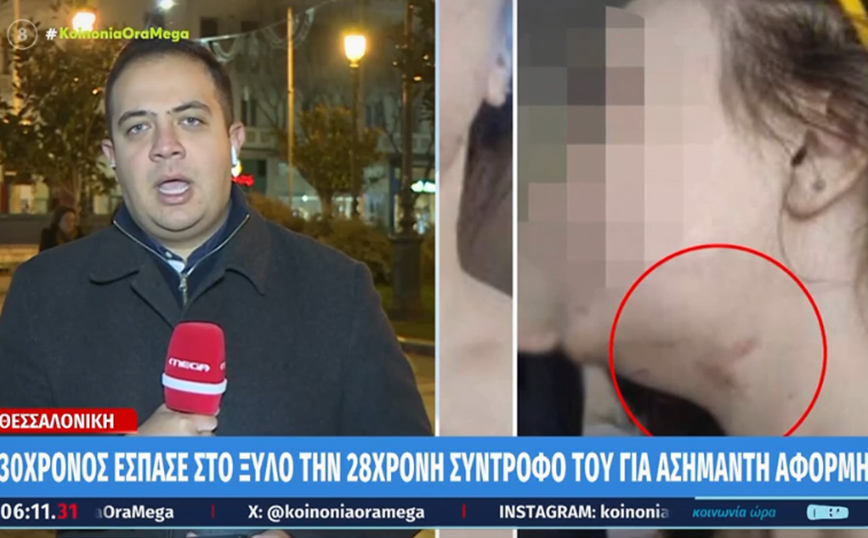 Συγκλονίζει ο άγριος ξυλοδαρμός 28χρονης από τον σύντροφό της – Πήδηξε από το μπαλκόνι, για να γλιτώσει