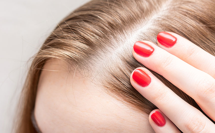 Ρίζα μαλλιού Ρίζα μαλλιού