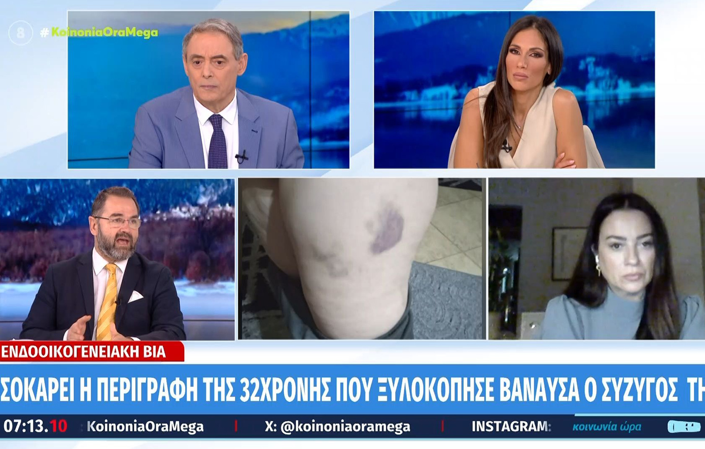 «Είναι τομάρι ολκής» – Έξαλλος ο Μπαλάσκας με τον άνδρα που χτύπησε τη σύζυγό του με σίδερο και της έριξε χλωρίνη