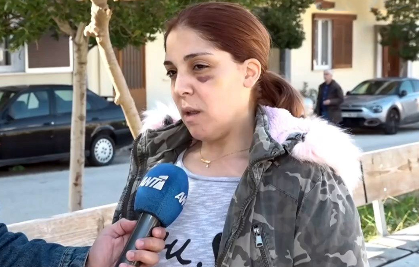 «Με βίασε, με χτύπησε, απείλησε να κάψει ζωντανά τα παιδιά μας» – Συγκλονίζει η 32χρονη Ελένη από το Άργος