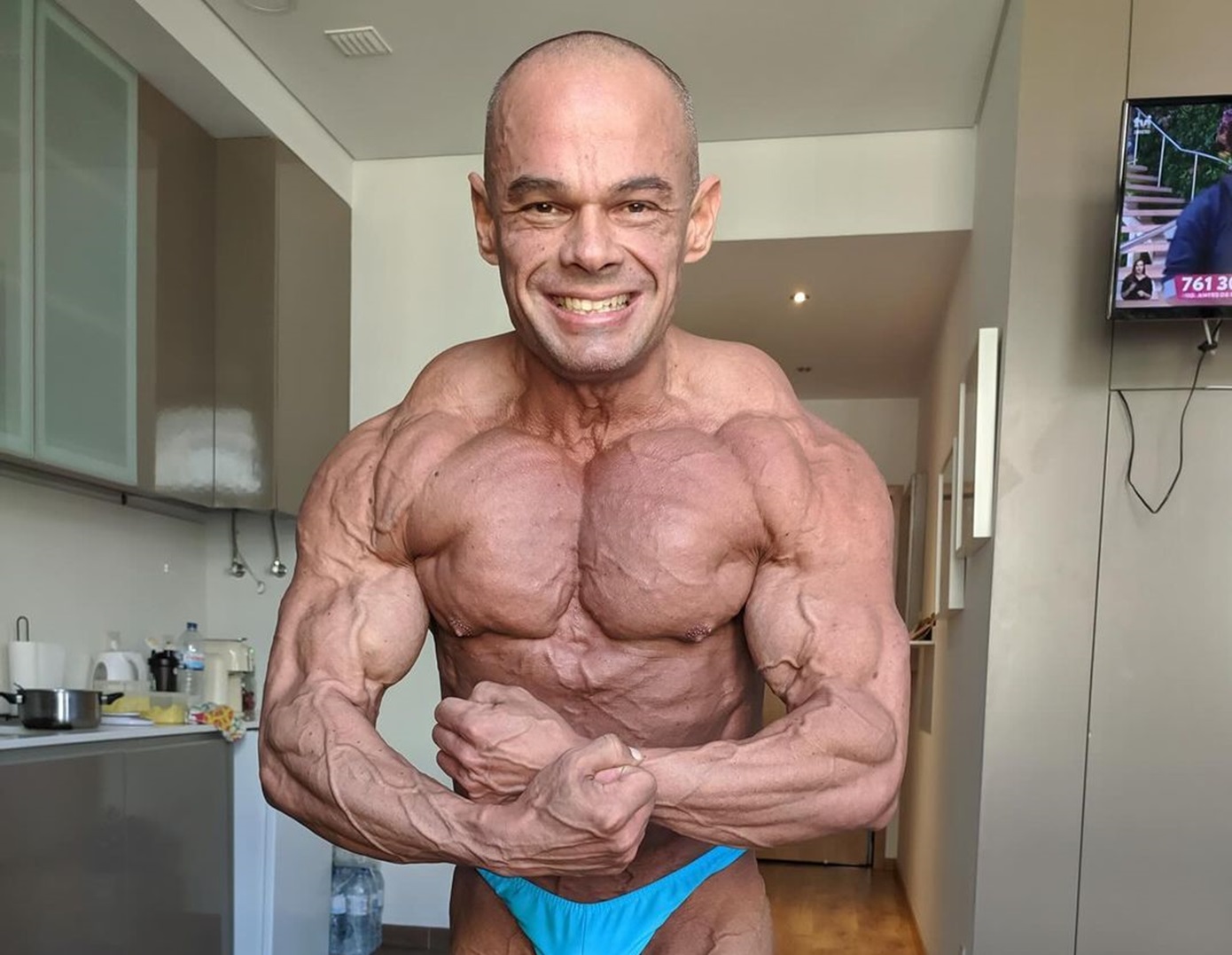 O bodybuilder, Μάρκο Λουίς, πέθανε στη Γερμανία – «Ο πιο καλοσχηματισμένος που υπήρξε ποτέ»