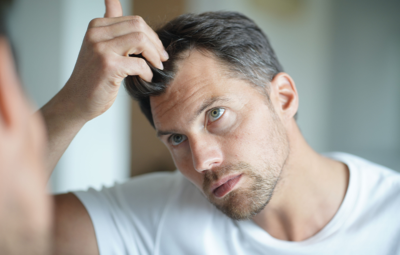 Όλα όσα πρέπει να γνωρίζετε για την απώλεια μαλλιών