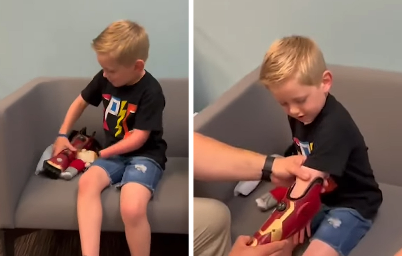 Αγοράκι 5 ετών απέκτησε το χέρι του Iron Man &#8211; Γεννήθηκε χωρίς αριστερό άκρο