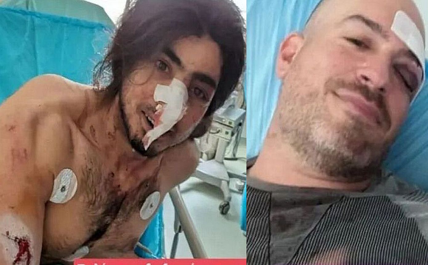 «Ήταν επτά άτομα και μας χτύπαγαν» – «Έχασα πολύ αίμα»: Συγκλονίζουν οι εθελοντές που δέχτηκαν επίθεση στην Πάρνηθα
