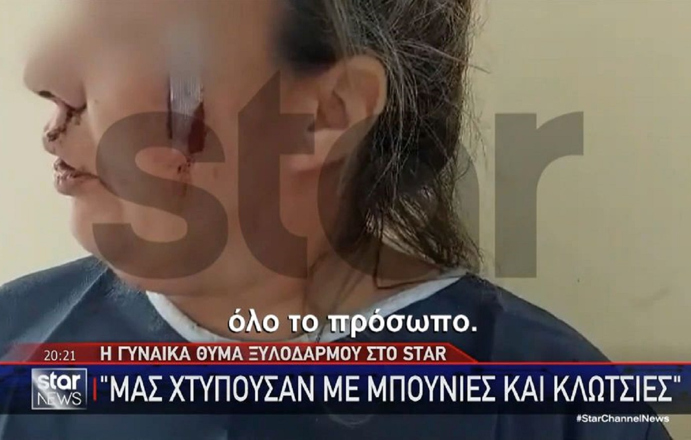 «Μπήκε στο αμάξι και ήθελε να τον πατήσει»: Οι δραματικές στιγμές που έζησε το θύμα στο άγριο ξύλο μεταξύ οδηγών στη Θηβών