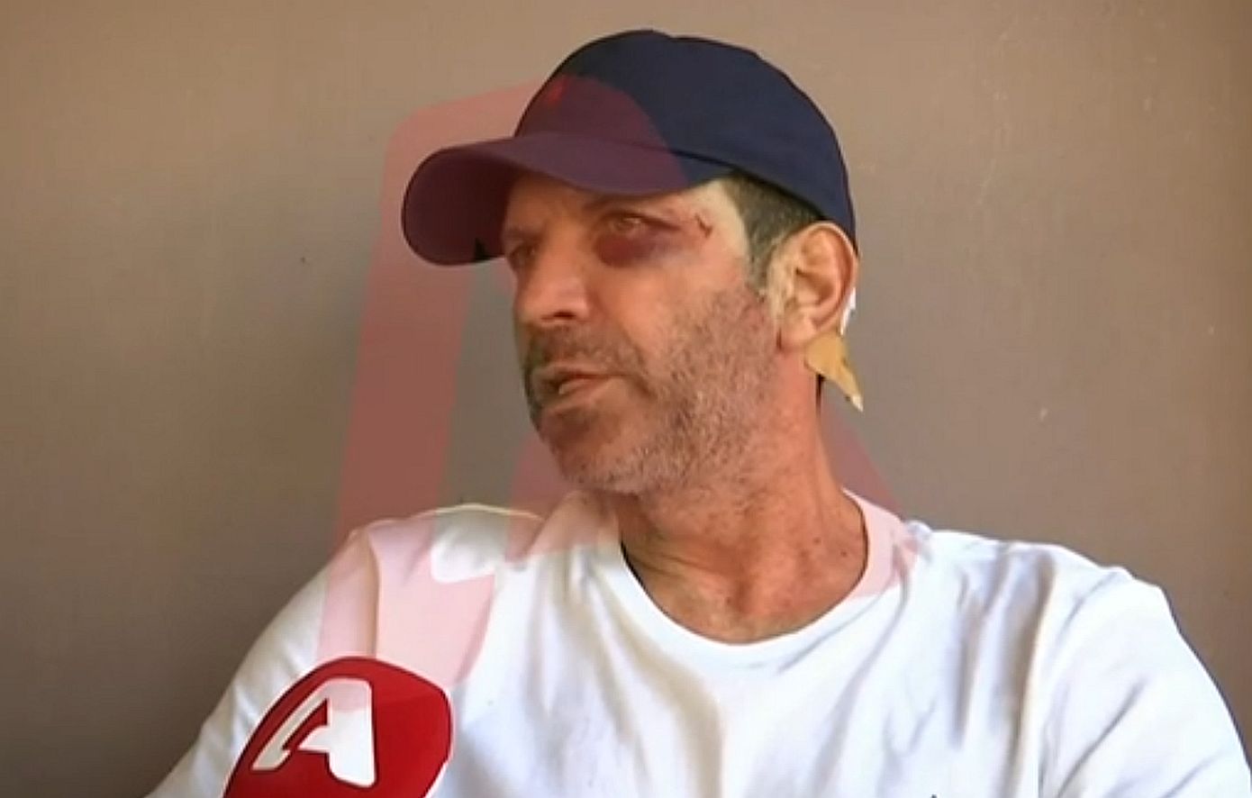 Αγρίνιο: Χτύπησαν εστιάτορα με γκλοπ γιατί δεν τους άρεσε το φαγητό – «Μου άνοιξαν το κεφάλι σε δύο σημεία»