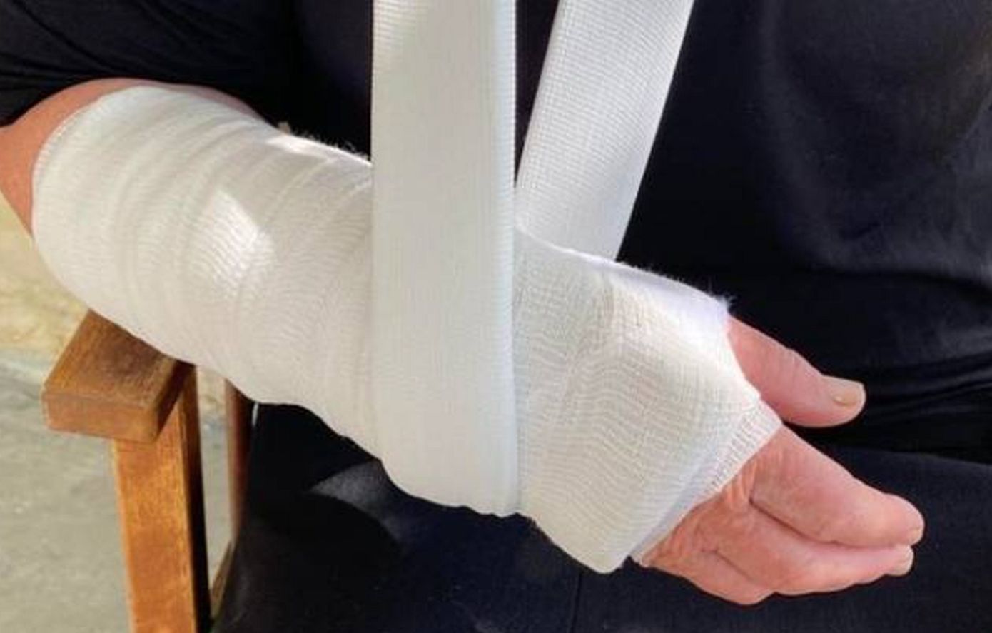 Αγρίνιο: Έσπασαν το χέρι ηλικιωμένης προσπαθώντας να την κλέψουν