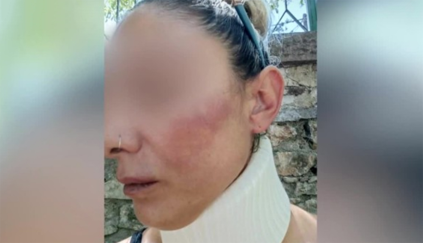 «”Θα σκοτώσω κι εσένα και το μωρό” – Έτρεχαν αίματα από το πρόσωπό μου»: Συγκλονίζει η σύντροφος του πυροσβέστη στη Λέσβο