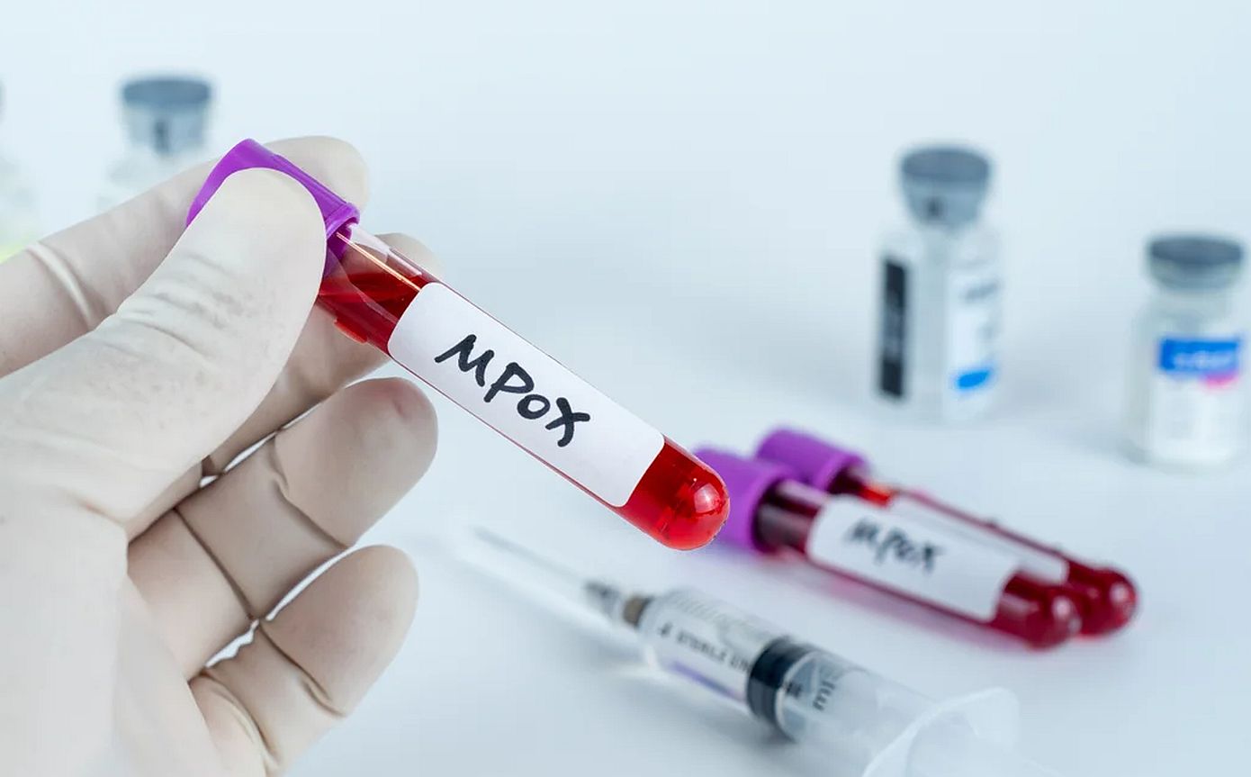 Ευλογιά των πιθήκων – Η mpox έφτασε ξανά στις Φιλιππίνες – Επιβεβαιώθηκε το πρώτο κρούσμα για το 2024
