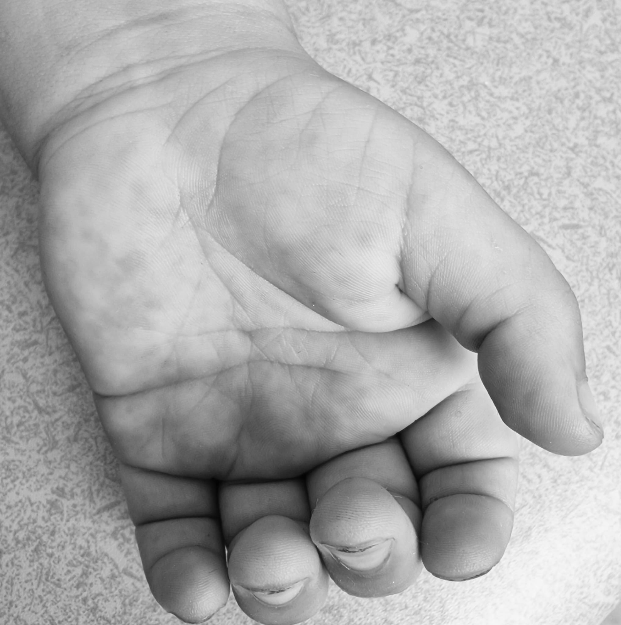Από εισρόφηση ο θάνατος του 15 μηνών βρέφους στην Αμαλιάδα – «Άγγελέ μου, γιατί έφυγες;» – H συγκλονιστική ανάρτηση γιατρού