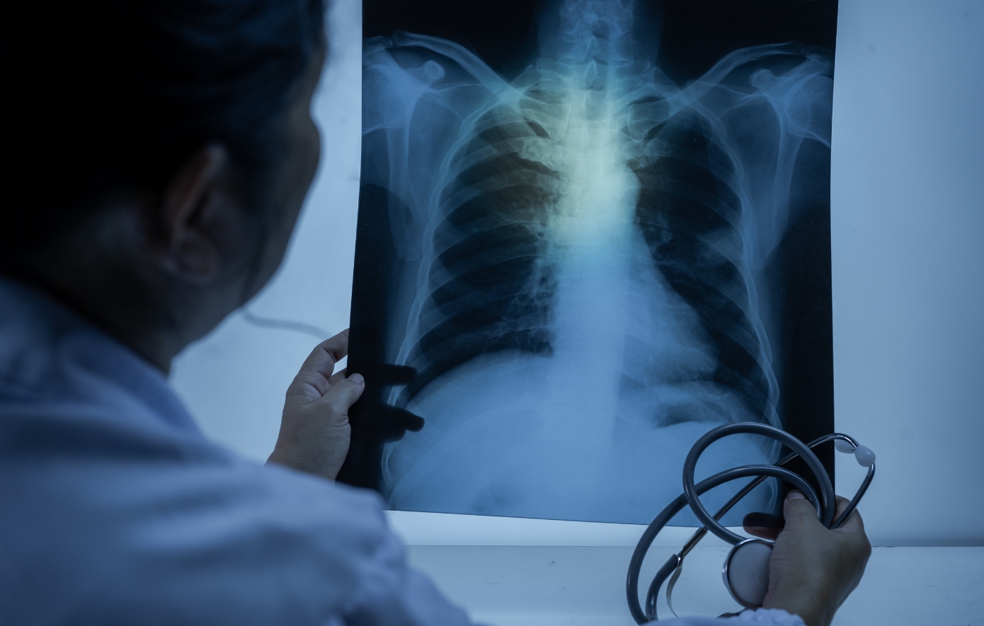 x ακτινες x ακτινες