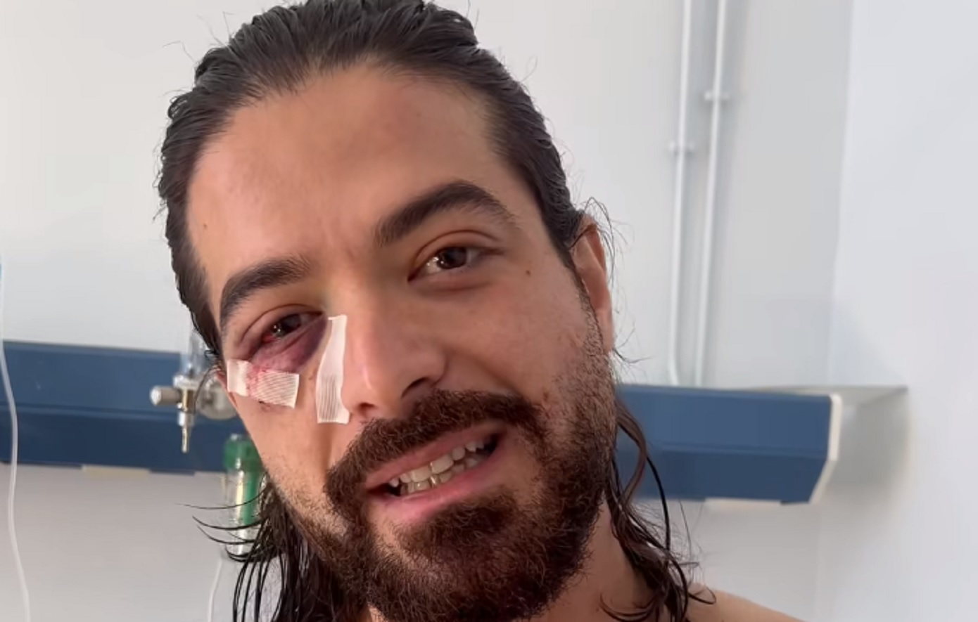 «Θα ξαναπαίξω κλαρίνο έστω και με ένα χέρι» λέει ο Άρης Μουγκοπέτρος – Βίντεο ντοκουμέντο αμέσως μετά το ατύχημα