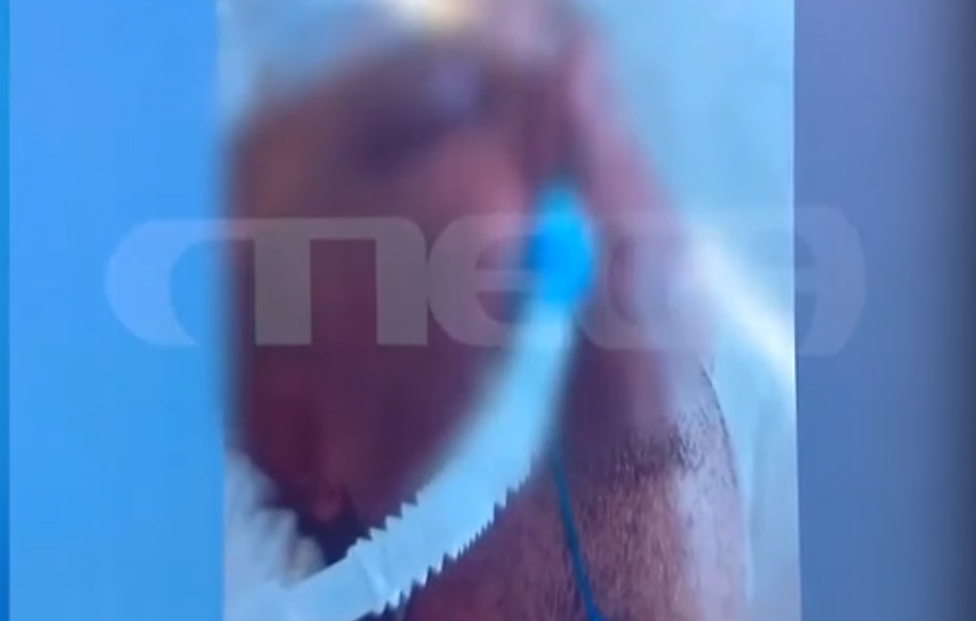 Χαροπαλεύει ο 50χρονος στα Γλυκά Νερά: «Μια γροθιά ήταν, αμυχή προκάλεσε» &#8211; Κυνικός ο δικηγόρος του 17χρονου