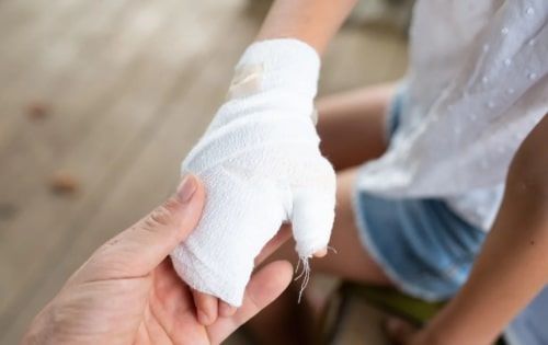 Έγκαυμα στο παιδί: Πώς να αντιδράσετε σωστά και γρήγορα