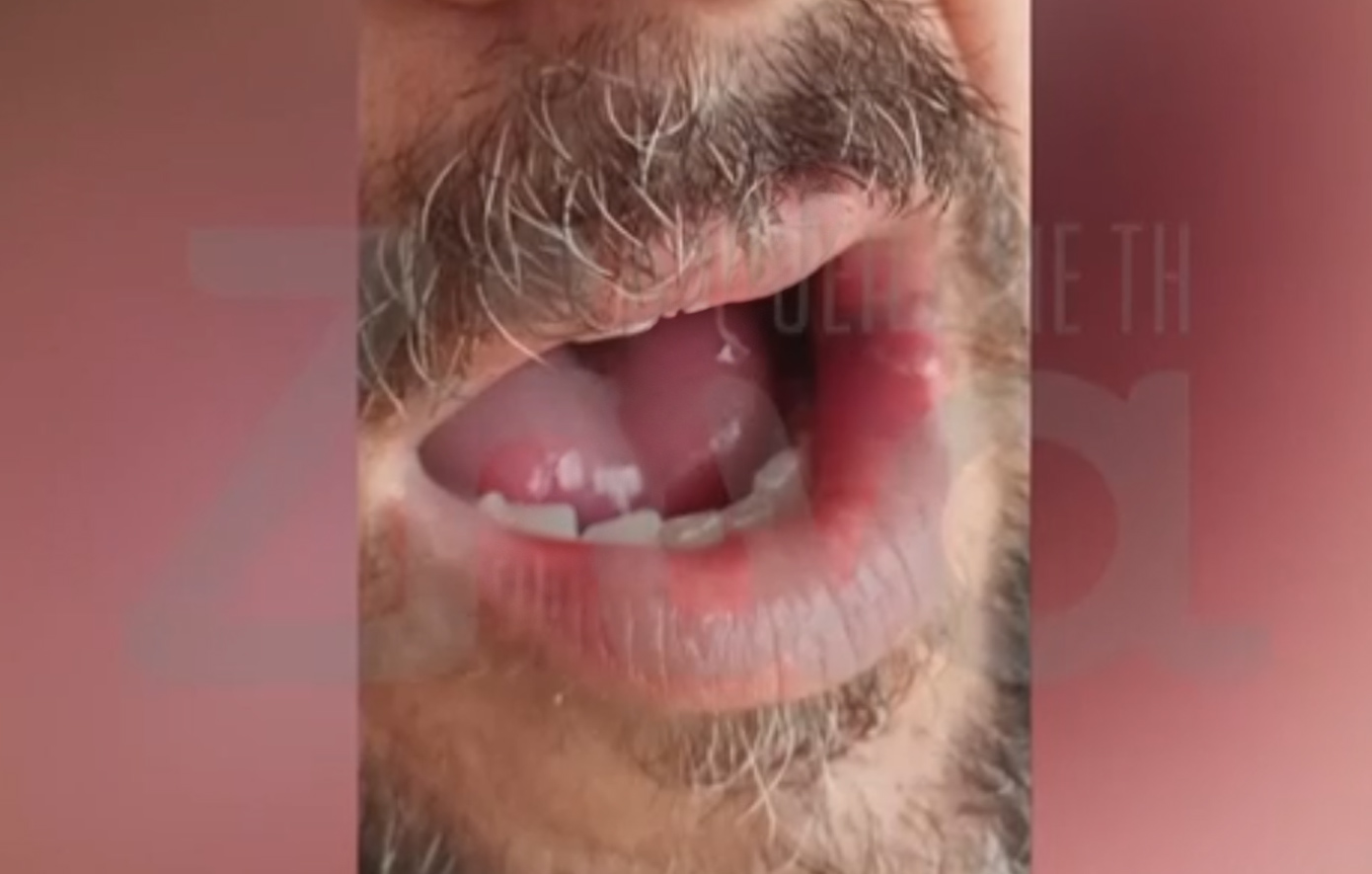 Ξύλο στη Μύκονο