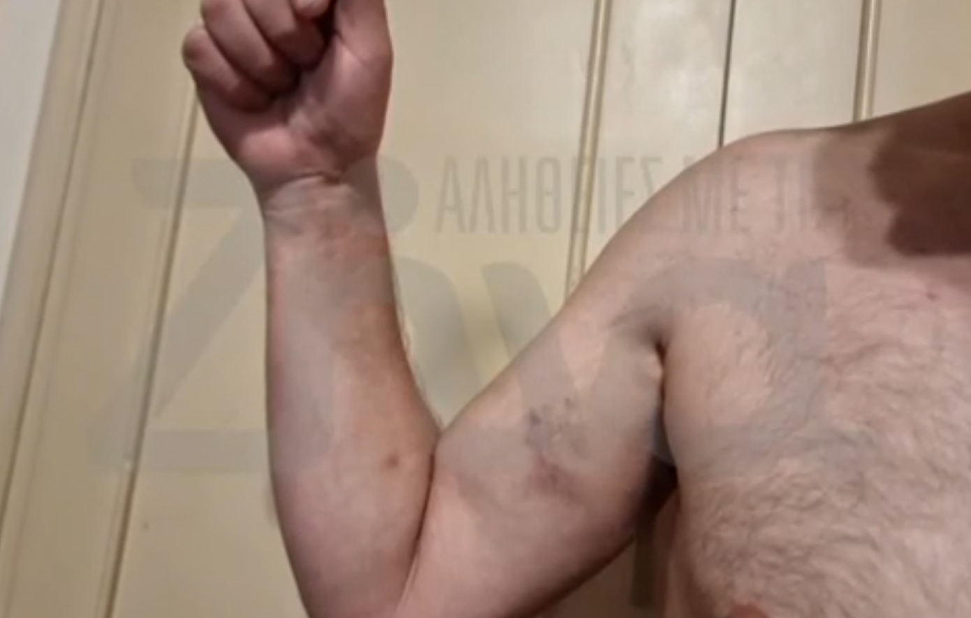 Ξύλο στη Μύκονο