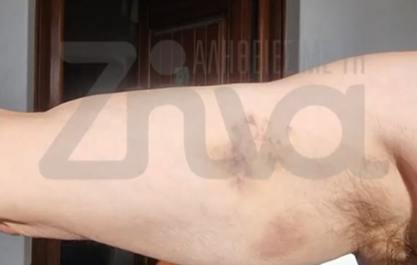 Ξύλο στη Μύκονο