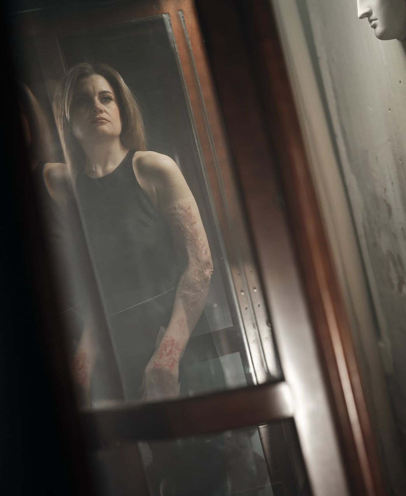 Ουκρανές τραυματίες πολέμου