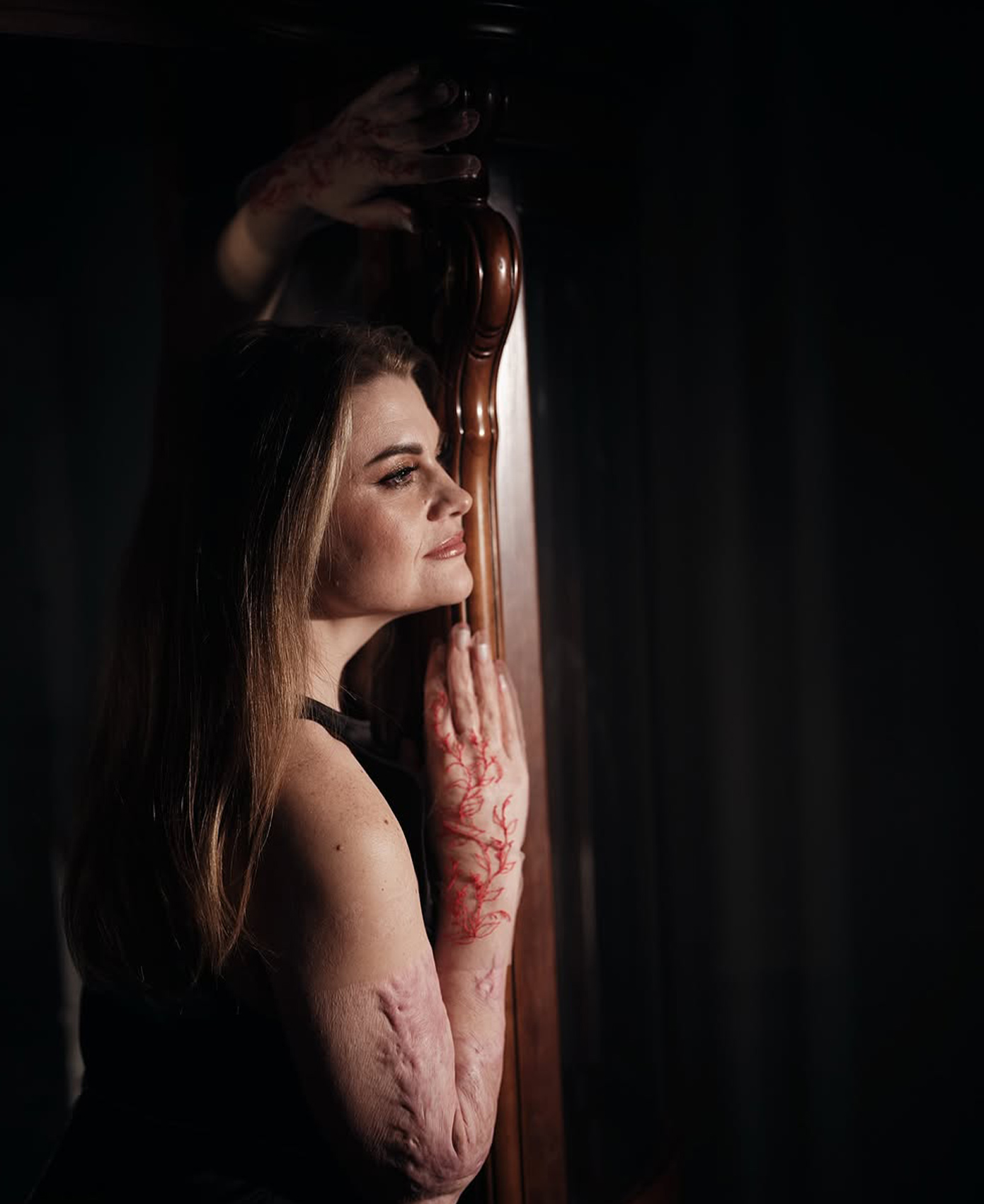 Ουκρανές τραυματίες πολέμου