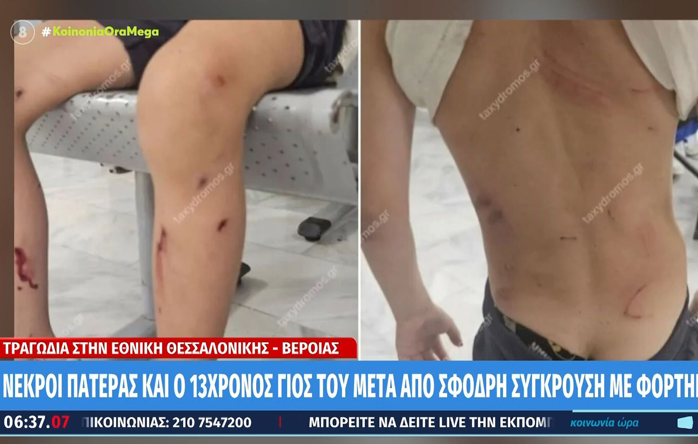 Αδέσποτα σκυλιά επιτέθηκαν και δάγκωσαν 7χρονο στον Βόλο