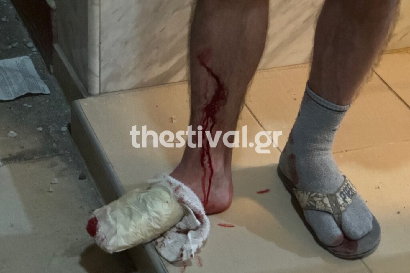 Τρομοκρατία «βλέπουν» οι Αρχές πίσω από την έκρηξη με τους 2 τραυματίες σε πολυκατοικία στη Θεσσαλονίκη