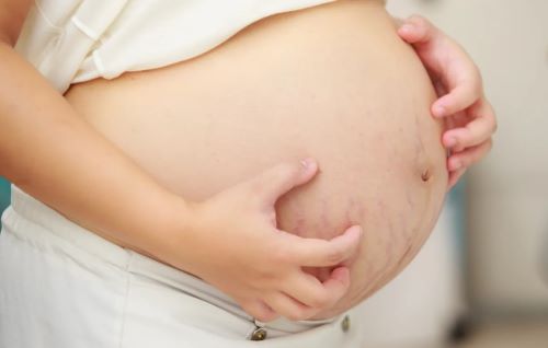 «Σταματήστε να μου λέτε ότι είναι υπέροχες οι ραγάδες μου από την εγκυμοσύνη»