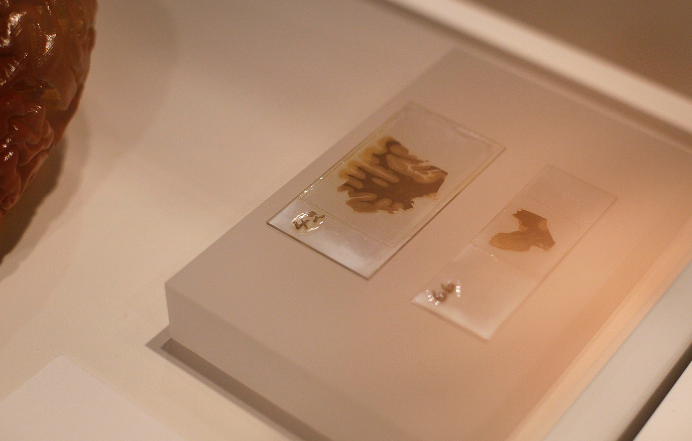 Εγκέφαλος Εγκέφαλος