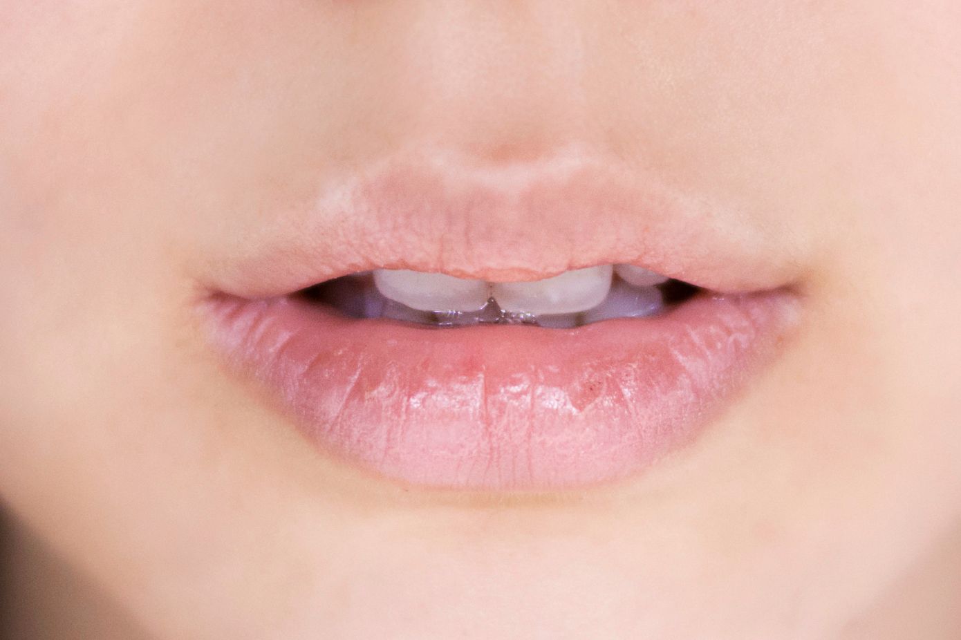 Concealer Lips: Η πιο απροσδόκητη- και κατά τη γνώμη μας εφιαλτική- επιστροφή από τα 00s