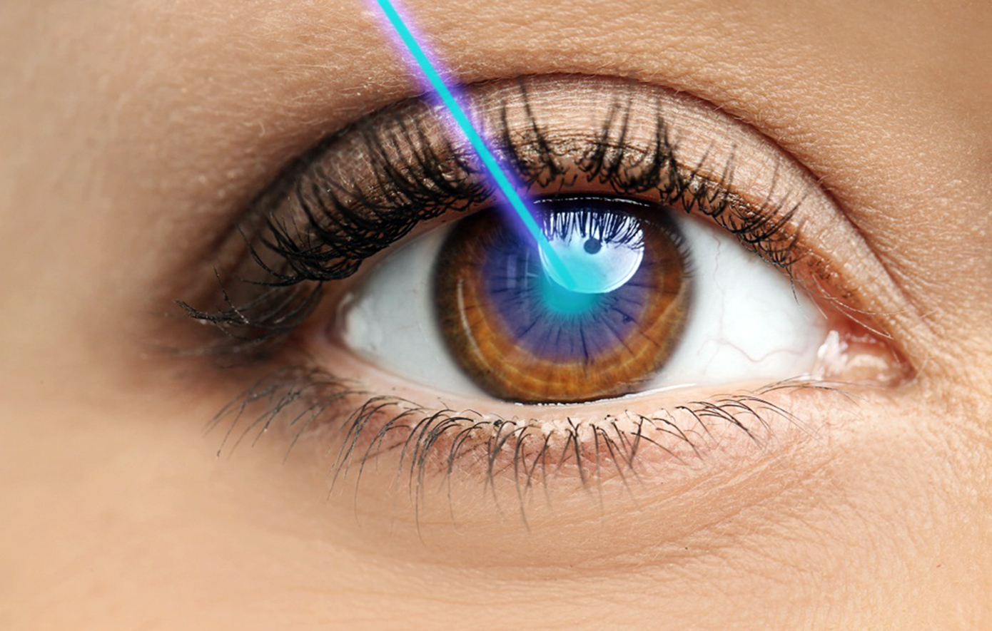 Η τεχνητή νοημοσύνη φέρνει επανάσταση στη διόρθωση μυωπίας