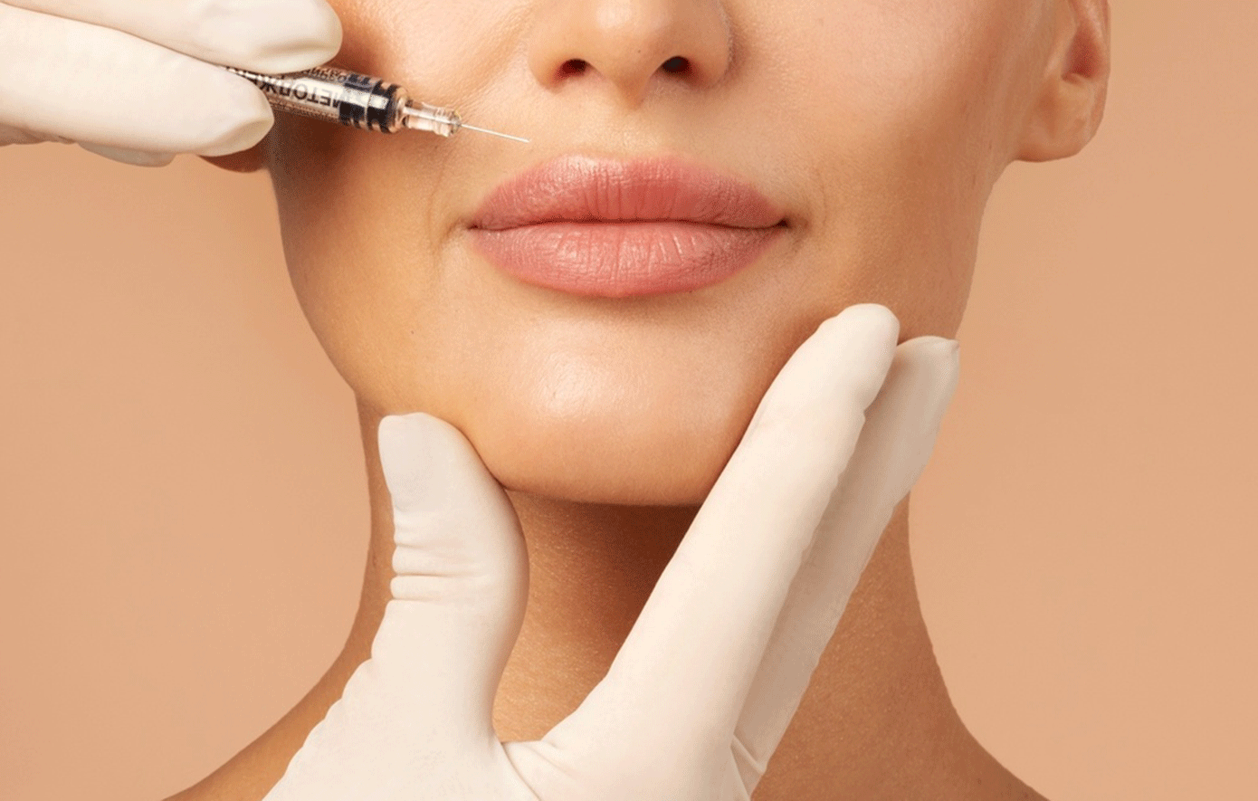Lip lift: Η νέα τάση στην ανόρθωση άνω χείλους για νεανικό χαμόγελο