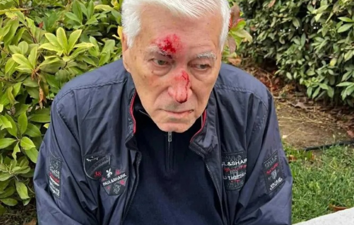 Θεσσαλονίκη: 82χρονος καταγγέλλει πως έπεσε θύμα ξυλοδαρμού &#8211; Τον χτύπησε με γροθιές γιατρός στη μέση του δρόμου