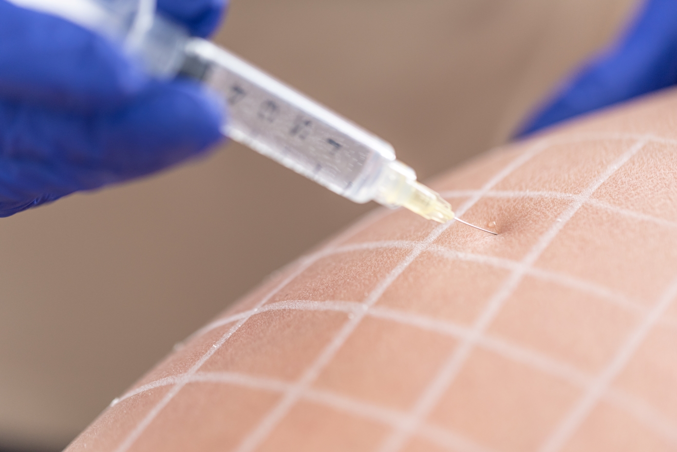 Νέο φάρμακο αδυνατίσματος οδηγεί σε απώλεια βάρους 20%, σύμφωνα με δοκιμές