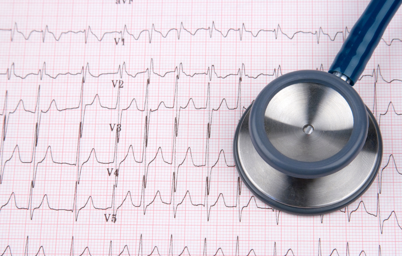 Καφές κατά της κολπικής μαρμαρυγής: 1 φλιτζάνι την ημέρα μπορεί να μειώσει τις αρρυθμίες κατά 39%