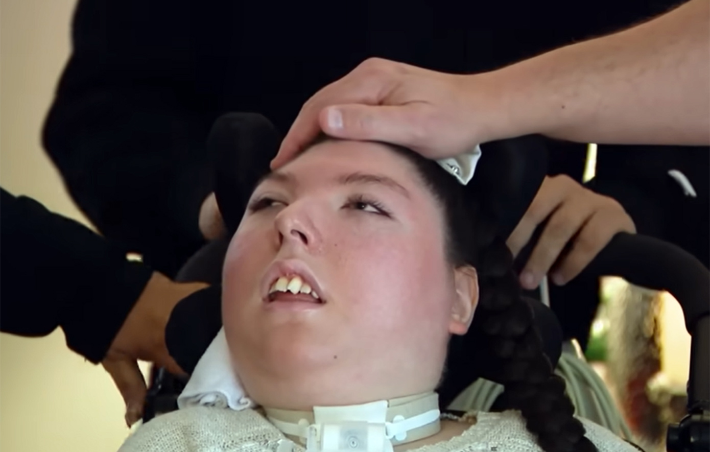 Το «ιατρικό θαύμα» της γυναίκας που γεννήθηκε χωρίς εγκέφαλο και έγινε 20 ετών &#8211; Είχαν πει ότι δεν θα ζούσε πάνω από 5 χρόνια