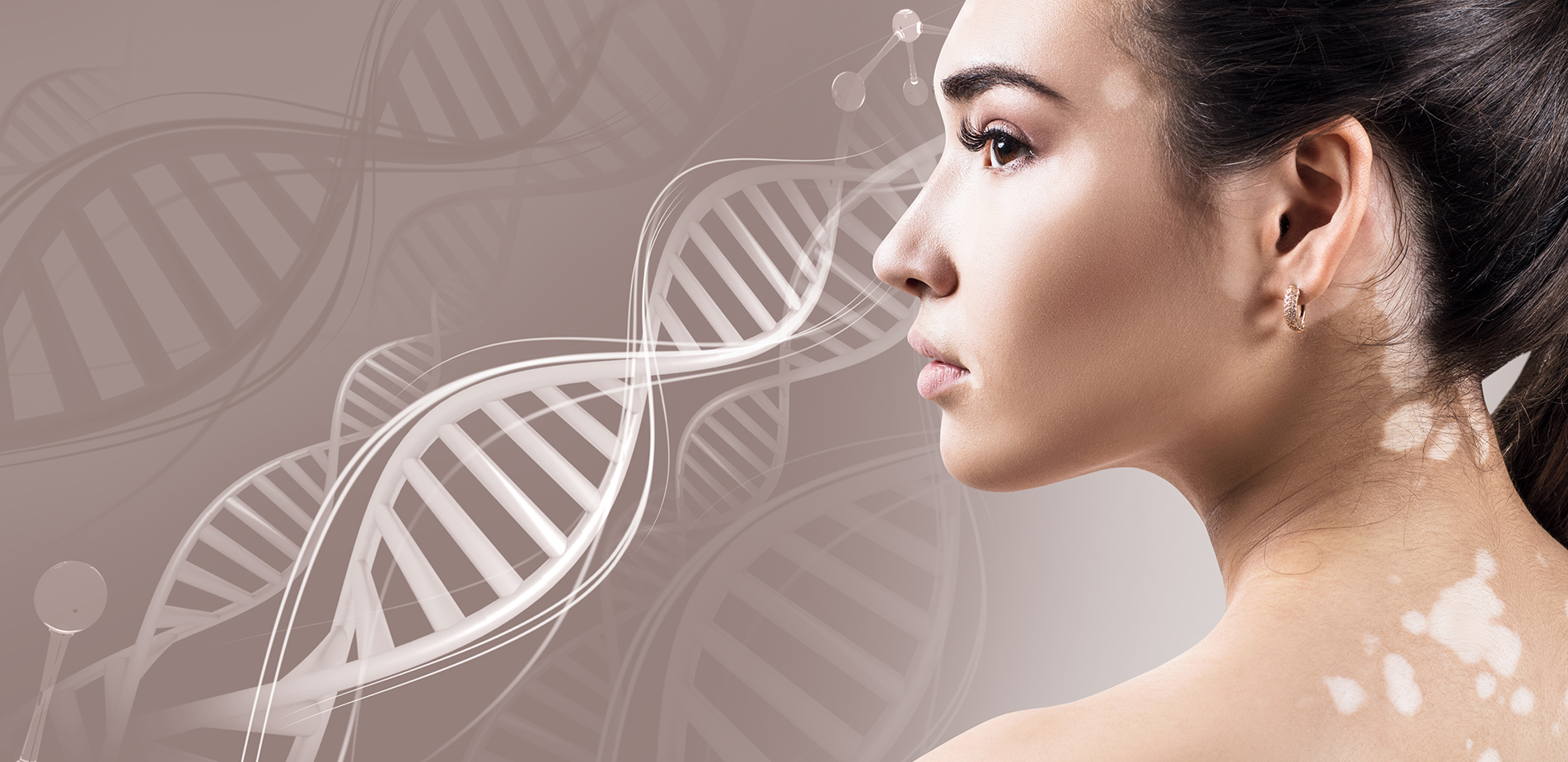 Λεύκη: Μία αυτοάνοση πάθηση που δεν πονά, αλλά “φαίνεται”