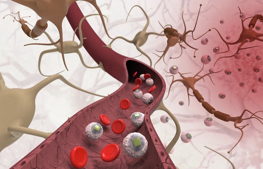 Υγεία από το μέλλον: Ερευνητές του MIT δημιούργησαν ενέσιμα τσιπ που εξαλείφουν την ανάγκη για χειρουργεία εγκεφάλου