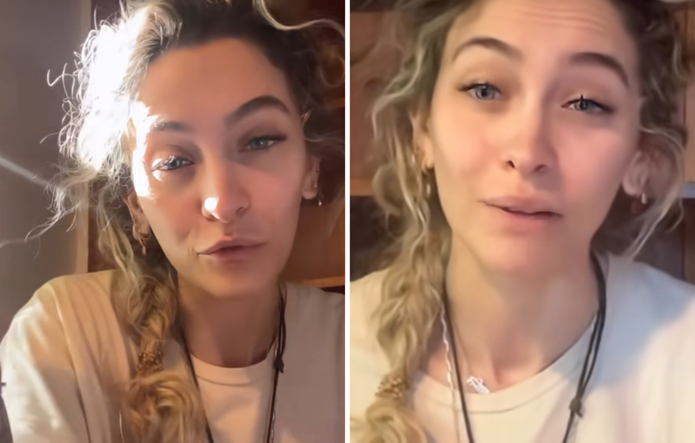 Η Πάρις Τζάκσον αποκαλύπτει μια παρενέργεια της χρήσης ναρκωτικών &#8211; Γιατί δεν θα υποβληθεί σε χειρουργική επέμβαση για να τη διορθώσει