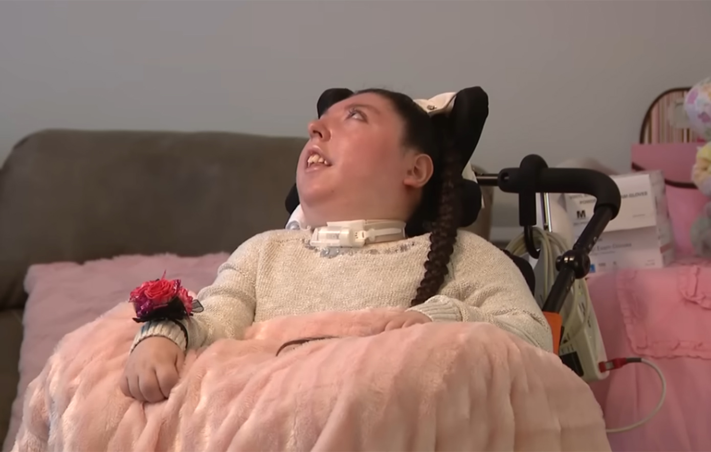 Γυναίκα που γεννήθηκε χωρίς εγκέφαλο έκλεισε τα 20 – Οι γιατροί δεν πίστευαν ότι θα ζούσε πάνω από 4 χρόνια