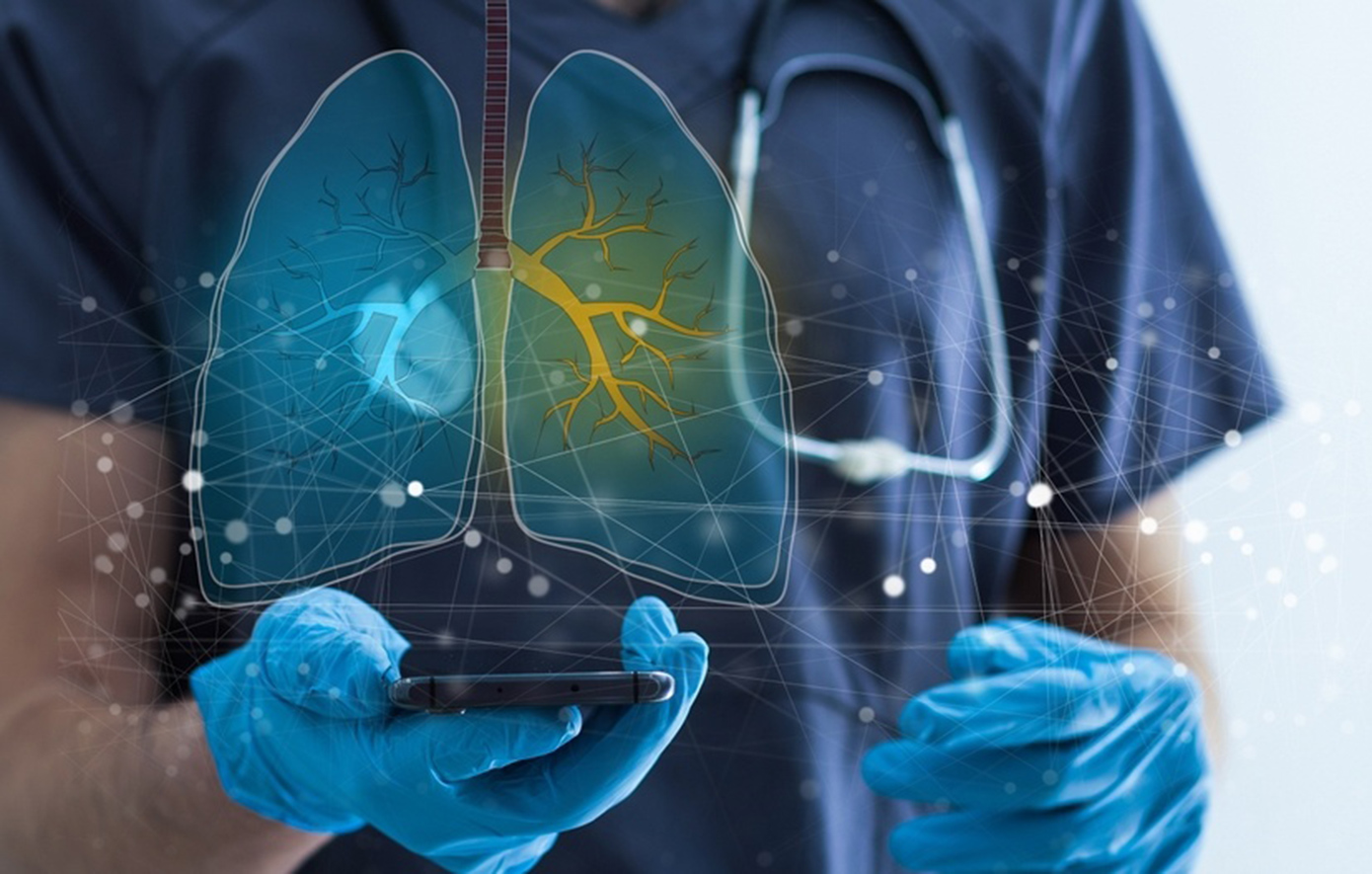 Ο καρκίνος του πνεύμονα δεν είναι πια ανίκητος – Νέα εποχή στη θεραπεία