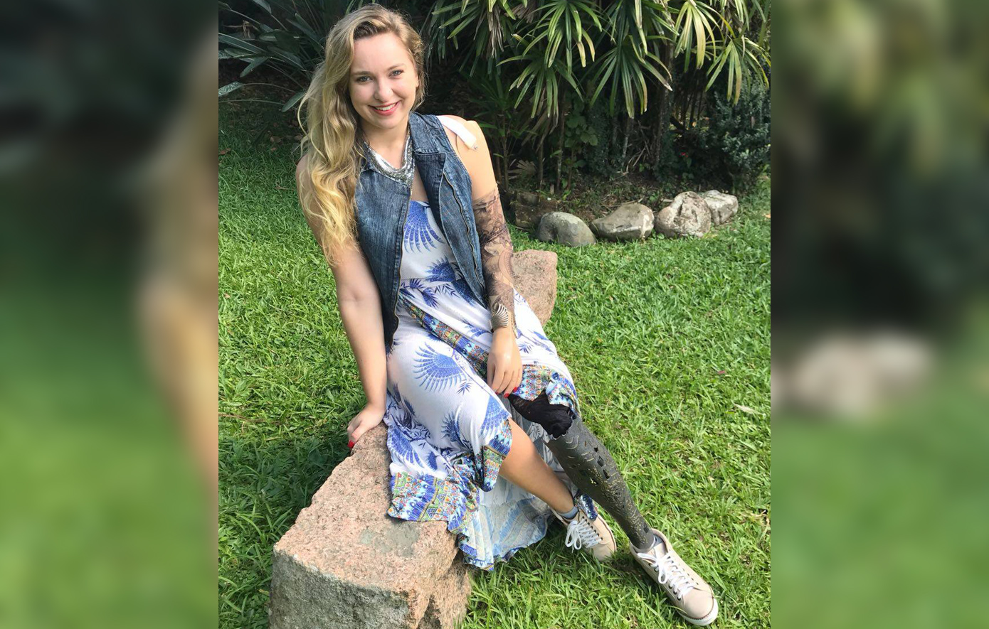 Τουρίστρια που έχασε το χέρι και το πόδι σε ατύχημα στο μετρό της Νέας Υόρκης κερδίζει αποζημίωση ύψους 82 εκατομμυρίων δολαρίων