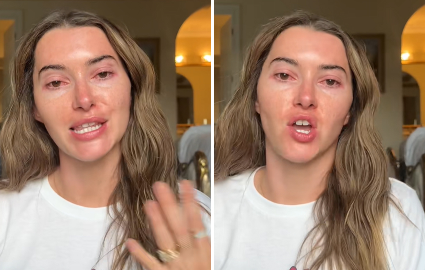 «Εγωίστρια» influencer ήρθε αντιμέτωπη με τις αντιδράσεις των θαυμαστών επειδή βγήκε το βράδυ ενώ είχε μεταδοτική λοίμωξη