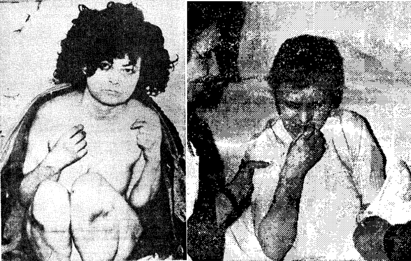 Σαν σήμερα 7 Νοεμβρίου: Η γυναίκα που ξαναείδε το φως του ήλιου μετά από 29 χρόνια κλειδωμένη &#8211; Η σιωπή ενός ολόκληρου χωριού