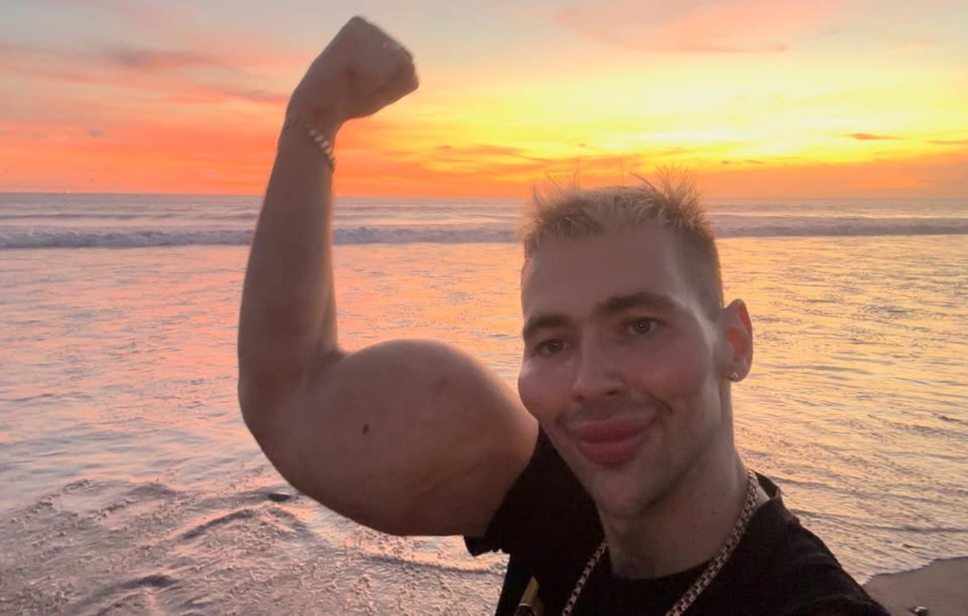 Κινδυνεύει να χάσει τα χέρια του ο «Ρώσος Ποπάι» &#8211; Έπαθε σοβαρή μόλυνση από τις ενέσεις για να μεγαλώσουν τα μπράτσα