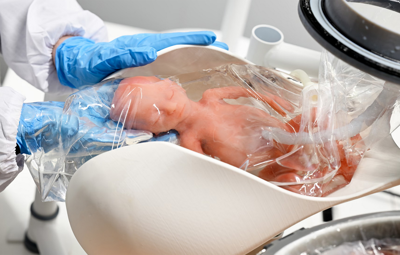 Τελειοποιείται τεχνητή μήτρα που μπορεί να κρατήσει ζωντανό ένα μωρό &#8211; Δυστοπία ή ελπίδα