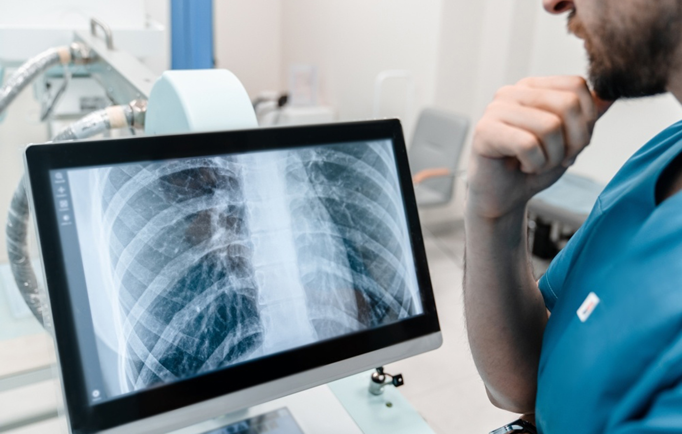 Η φονικότερη μολυσματική νόσος παγκοσμίως, με 1,23 εκατ. θανάτους το 2024