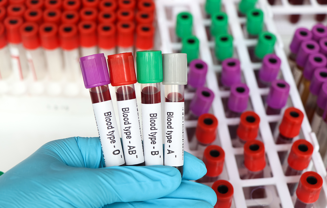 Τα πλεονεκτήματα και τα μειονεκτήματα των ομάδων αίματος Α, Β, ΑΒ, Ο &#8211; Ποιος διατρέχει μεγαλύτερο κίνδυνο για καρκίνο, νοροϊό και τσιμπήματα εντόμων