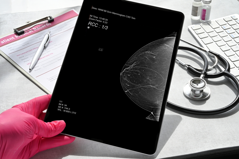 Παθήσεις μαστού: Πότε πρέπει να ξεκινά ο προληπτικός έλεγχος;