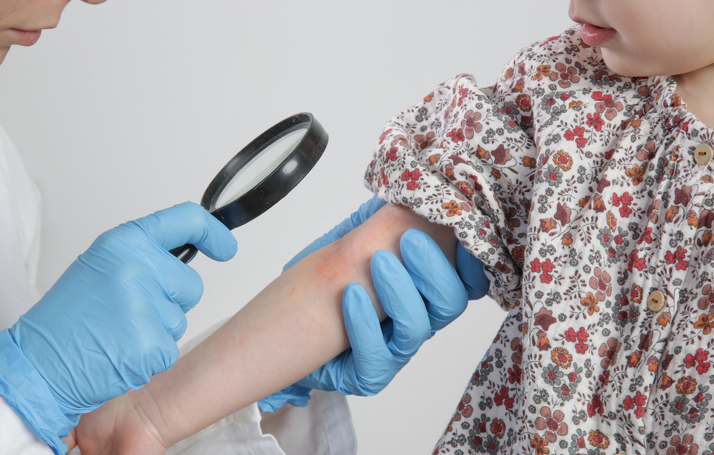 Εξατομικευμένη φροντίδα για τις αλλεργίες των παιδιών: Από τη διάγνωση μέχρι τη θεραπεία