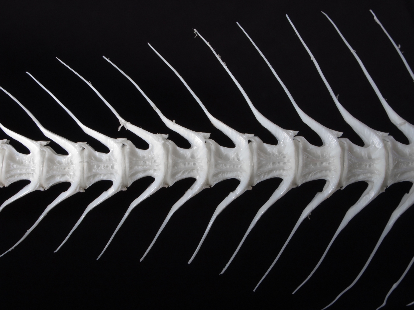 Δεν κινδυνεύετε μόνο να σας κάτσει στον λαιμό &#8211; Οι κίνδυνοι αν καταπιείτε κόκαλο ψαριού και τι μπορείτε να κάνετε