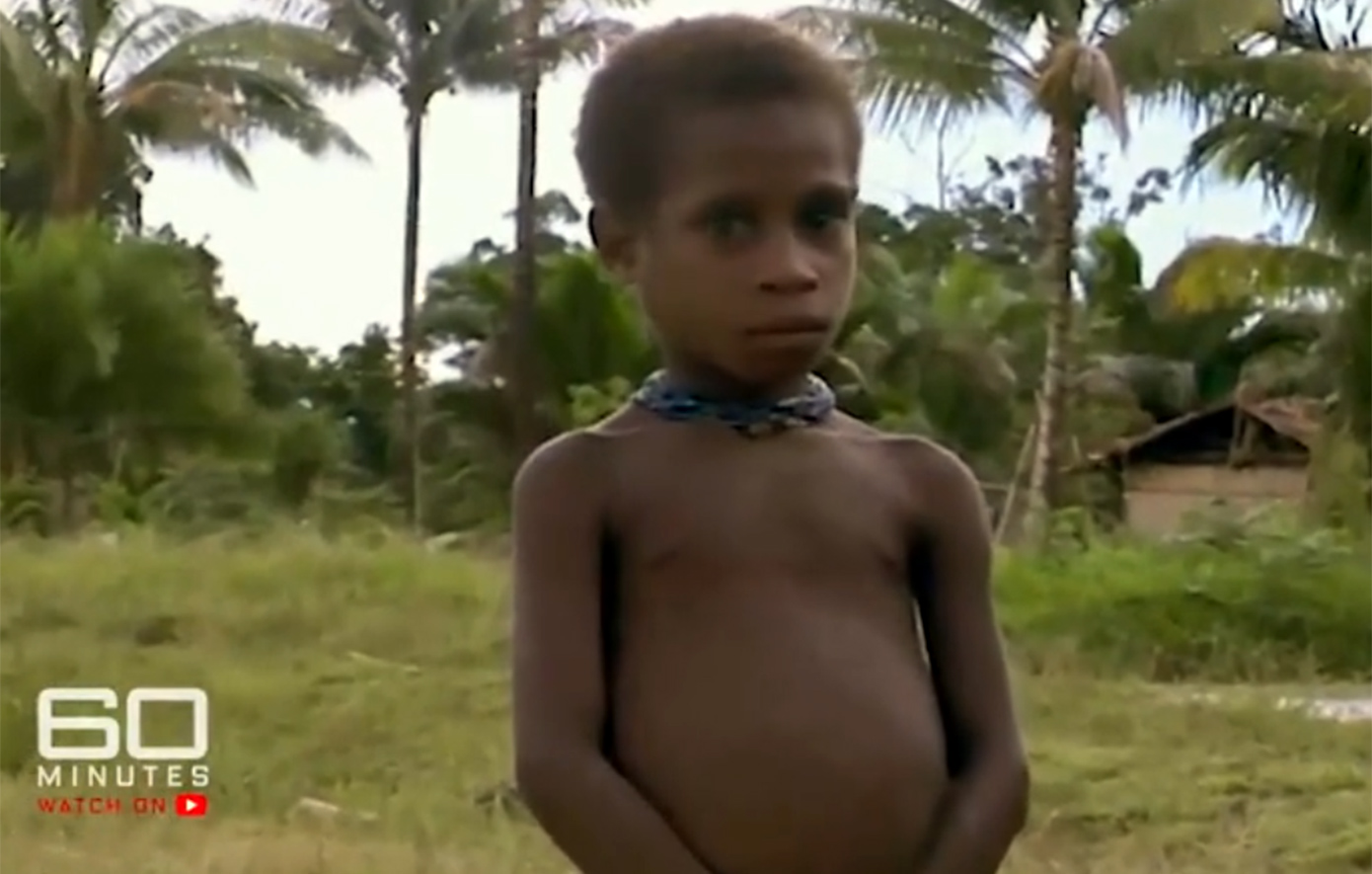 Η ιστορία του μικρού αγοριού που είχε καταδικαστεί ως «αρσενική μάγισσα» και κινδύνευε να φαγωθεί από κανίβαλους